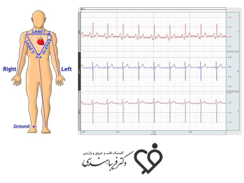 نوار قلب