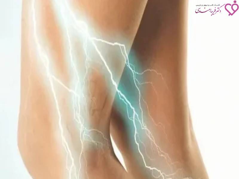 بهترین مرکز لیزر واریس در سعادت آباد