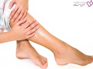 پماد برای واریس