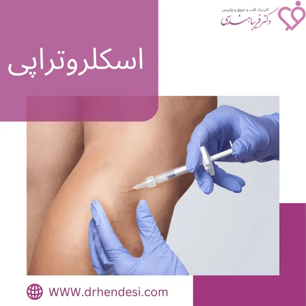 اسکلروتراپی 