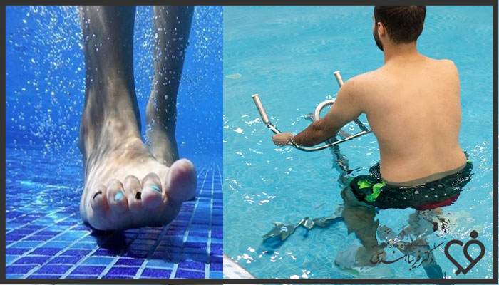 ورزش در آب برای افراد مبتلا به واریس