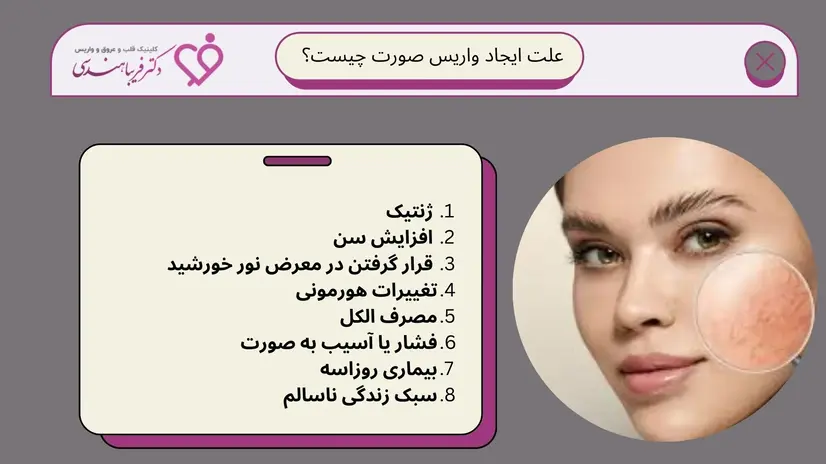 واریس صورت