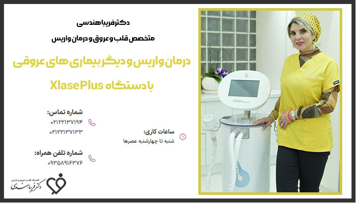 درمان واریس با دستگاه XLaseplus