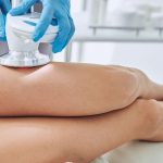 درمان سلولیت با لیزر - دکتر فریبا هندسی