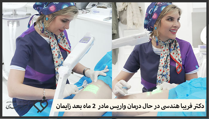 نمونه کار دکتر فریبا هندسی درمان واریس