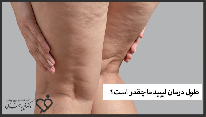 طول درمان لیپیدما