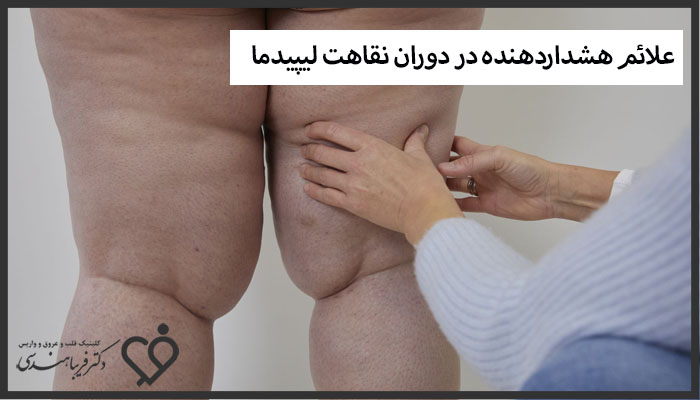 علائم هشداردهنده در دوران نقاهت لیپیدما