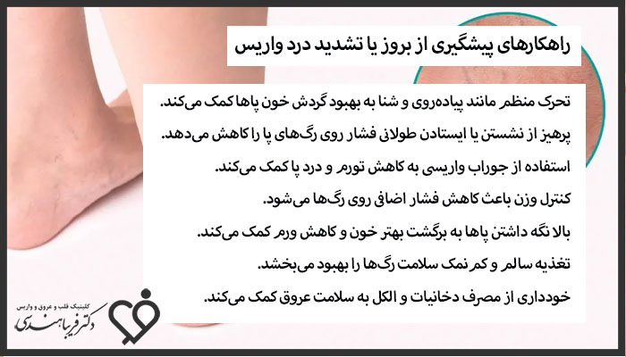 پیشگیری از بروز یا تشدید درد واریس