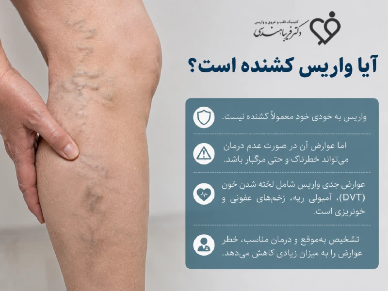 آیا واریس کشنده است؟