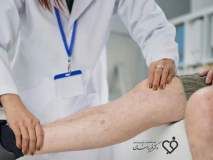 درمان بیماری شریان محیطی
