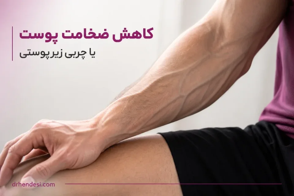 نمای توضیحی درباره کاهش ضخامت پوست یا چربی زیرپوستی