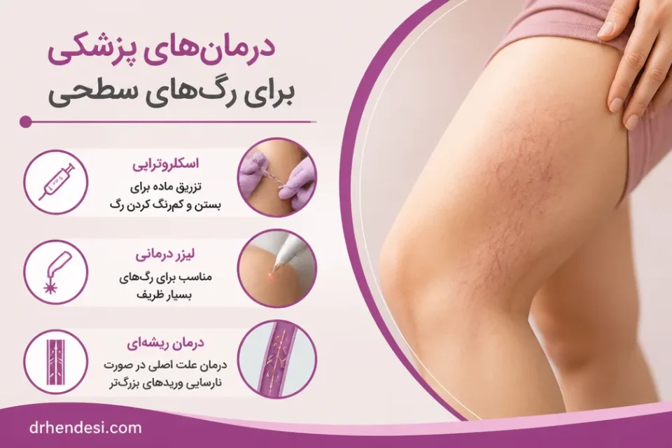 نمای توضیحی درباره درمانهای پزشکی برای رگهای سطحی