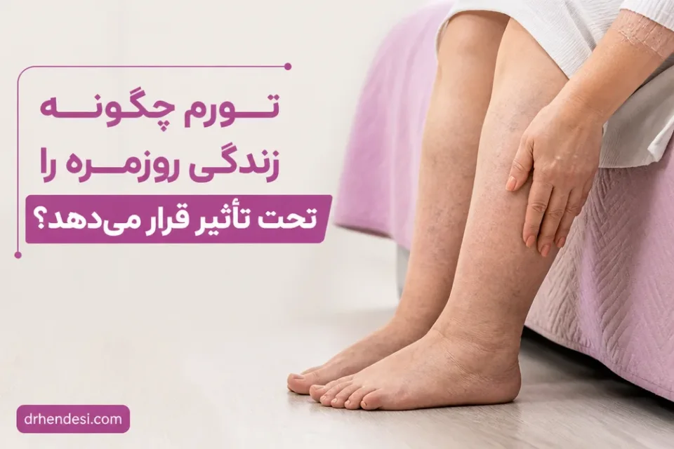 نمای توضیحی درباره تورم چگونه زندگی روزمره را تحت تأثیر قرار میدهد