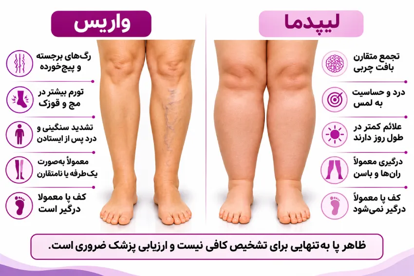 مقایسه واریس و لیپدما